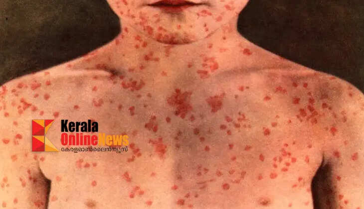 Malaria outbreak in Bangladesh; over 30,000 confirmed cases