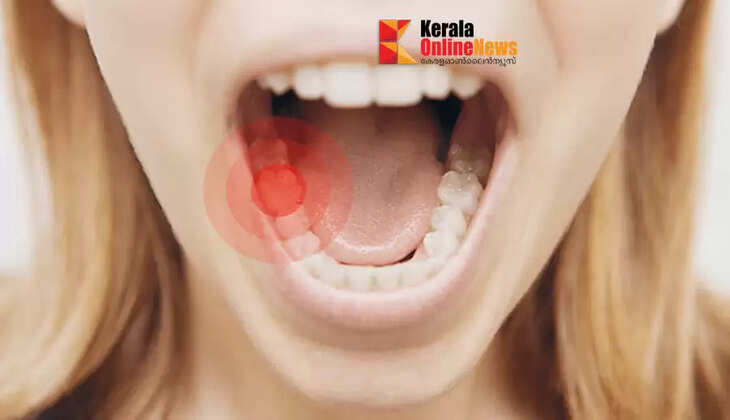 Toothache can be eliminated in minutes