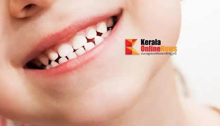 teeth