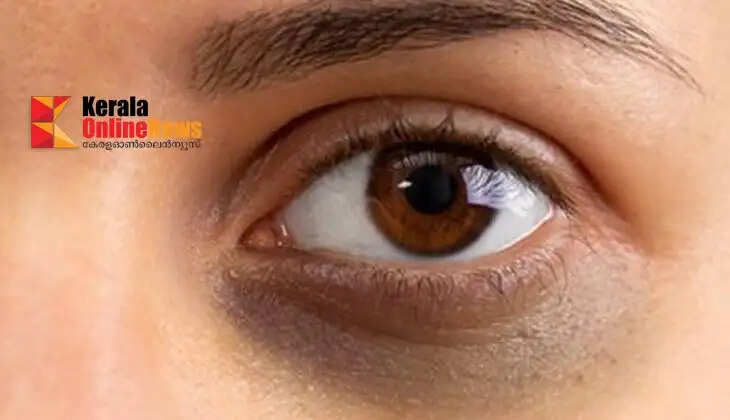 darkcircles