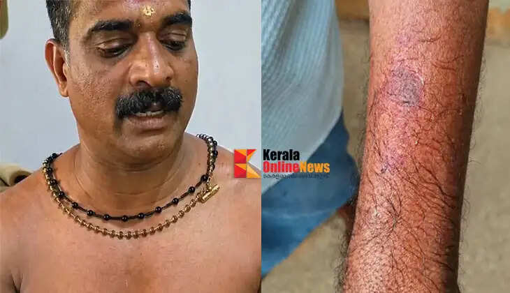 A middle-aged man who was traveling in a car in Kunnamkulam suffered a heatstroke