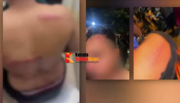 Clashes between police and SFI activists during DJ party in Shankhumukham, Thiruvananthapuram