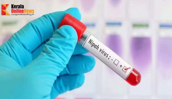 nipah virus