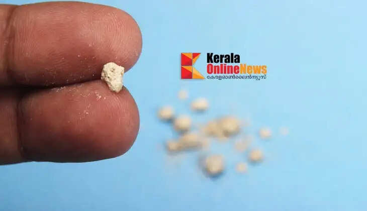 kidneystones