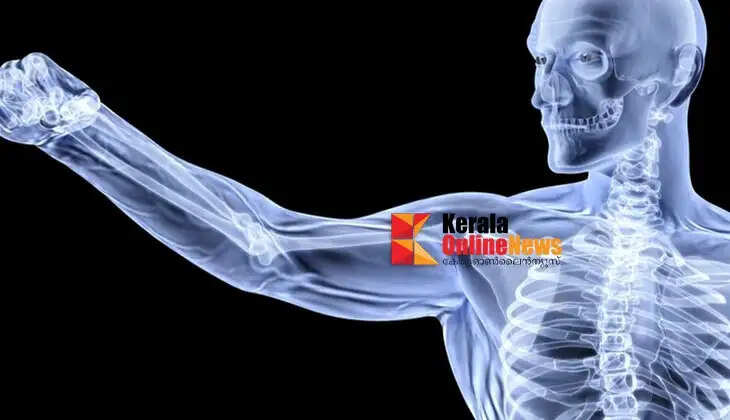 strongbones