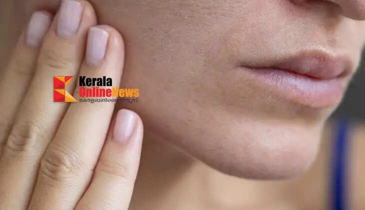 dry skin
