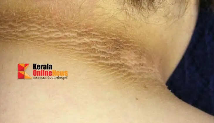 neckblack