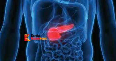 Pancreatic Cancer