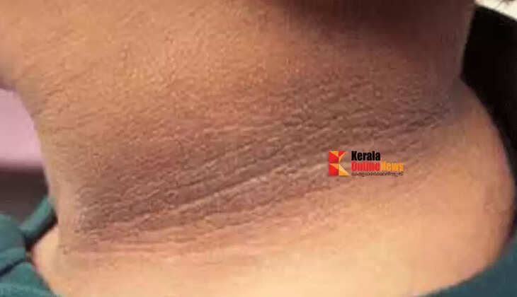 neck