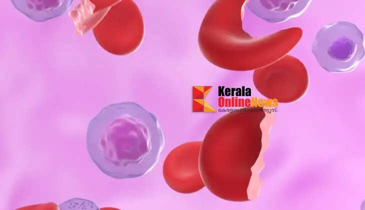 Anemia