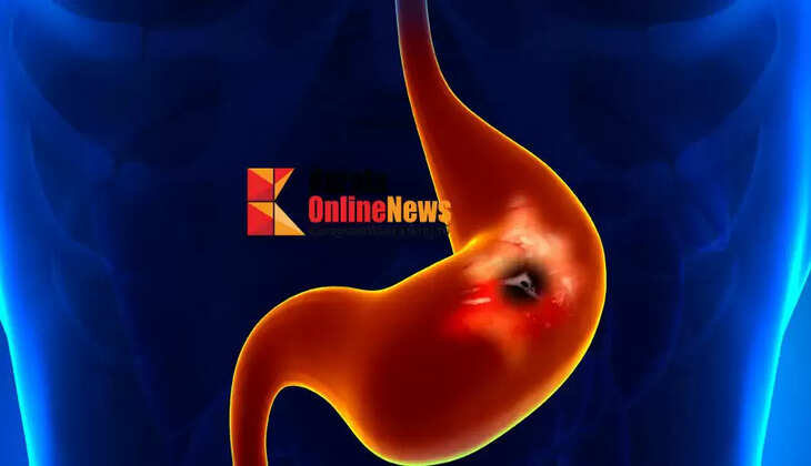 peptic ulcers