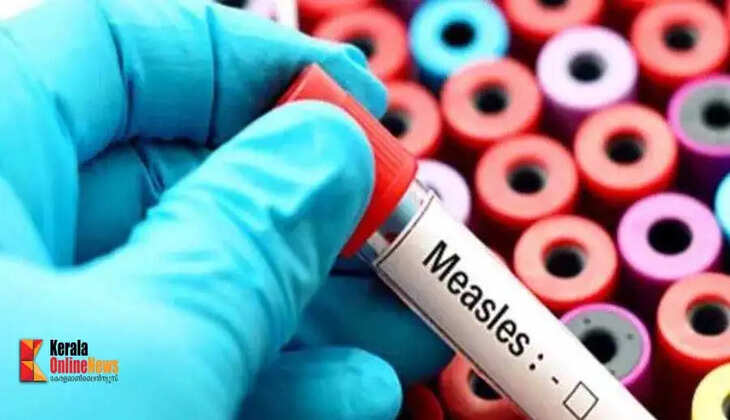 measles