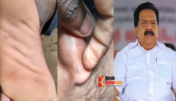 chennithala