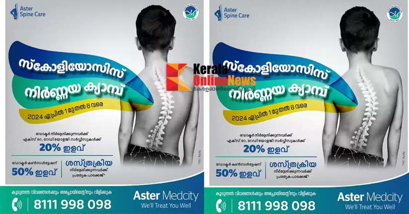 Scoliosis screening camp at Aster Medcity; Huge discounts on medical expenses