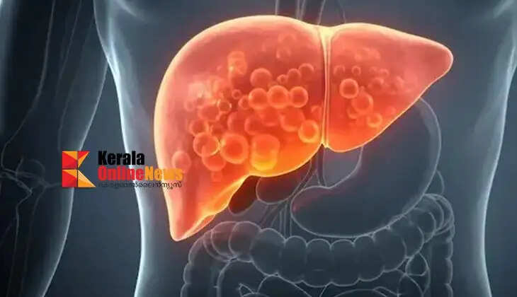 fatty liver disease