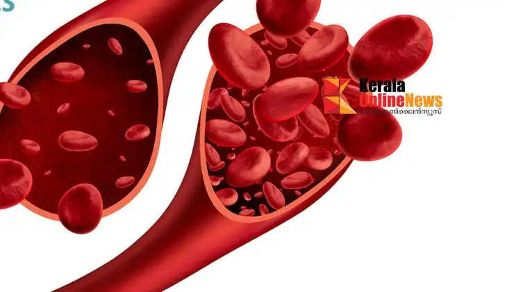 increaseredbloodcells
