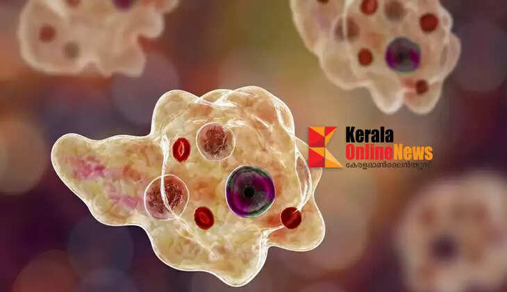 Amoebic meningoencephalitis