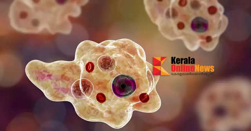 Amoebic meningoencephalitis