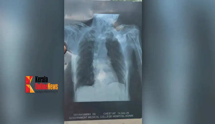 xray