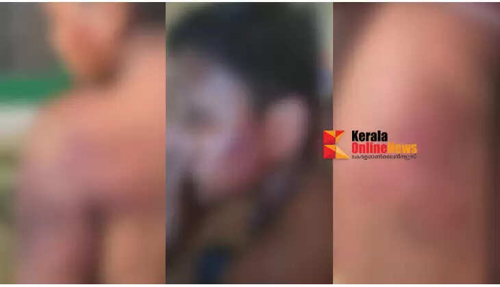 Teacher brutally beats up differently-abled youth for allegedly stealing in Kozhikode