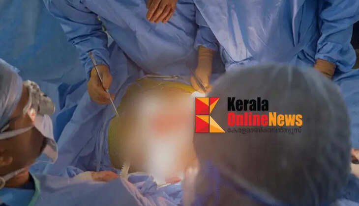 Kannur Aster MIMS successfully completes first cadaveric kidney transplant surgery in North Malabar