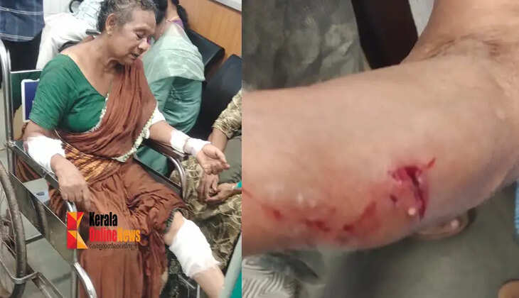 dog bite