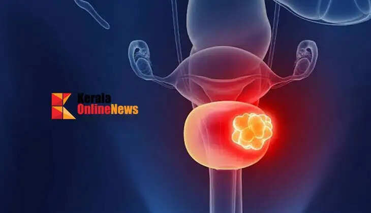 bladdercancer