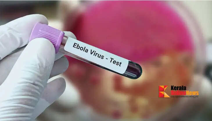 Fears are over...! Woman who returned from Uganda in Bengaluru confirmed to be Ebola-free