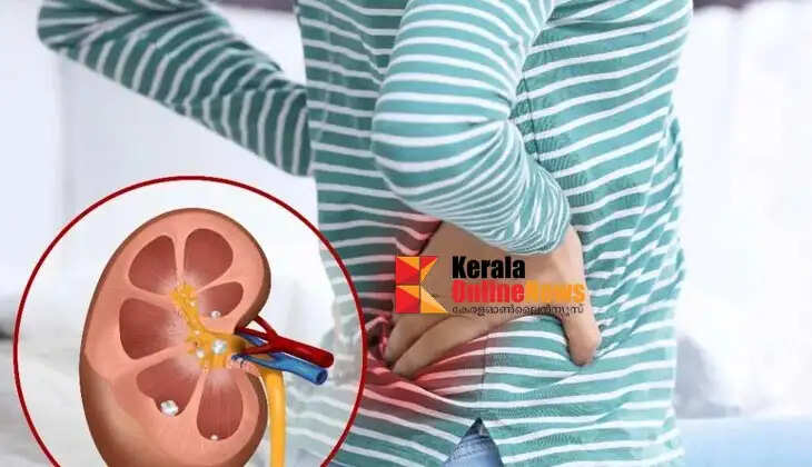 kidneystones