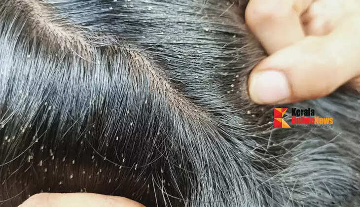 lice