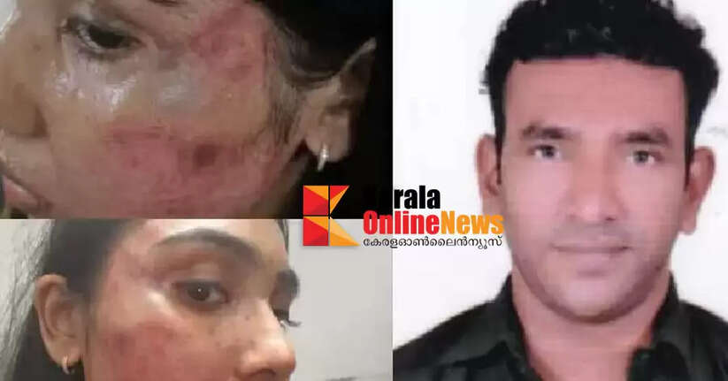 Junior lawyer brutally assaulted in Vanchiyoor court; Youth Commission registers case on its own initiative