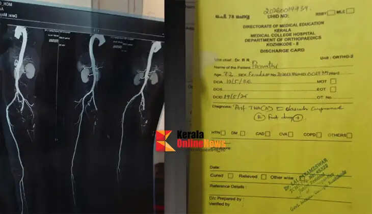 Another accident...! An elderly woman's leg nerve was severed during a surgery at Manjeri Medical College.