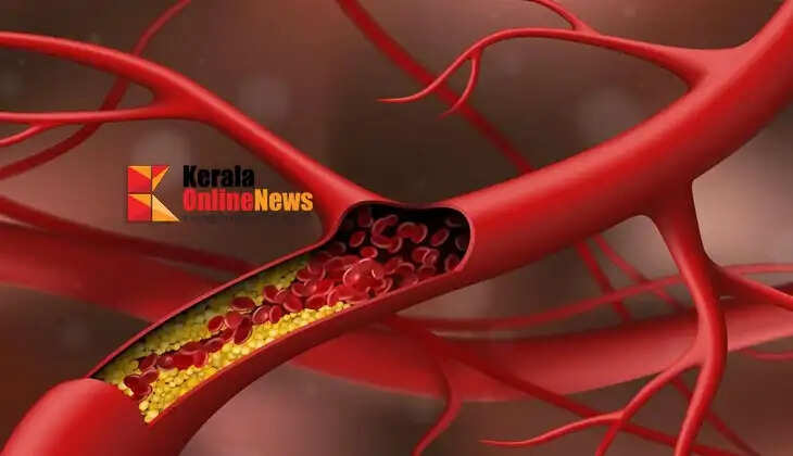 cholesterol