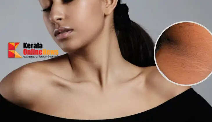 Don't ignore dark spots on your neck; could there be a deadly disease lurking behind them?