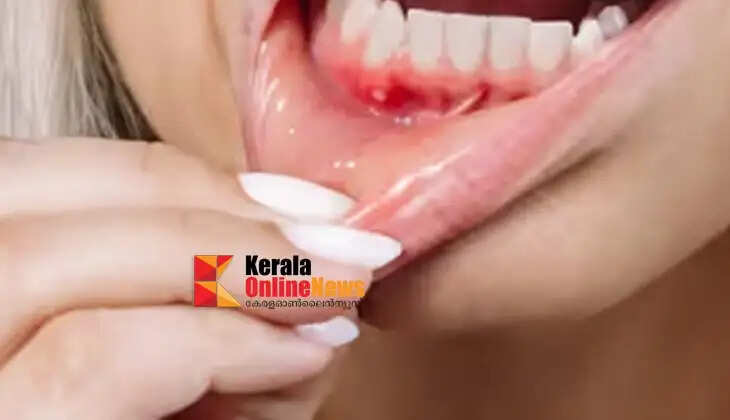 Sore throat? Don't run to the drugstore, the best medicine for this is in the kitchen!