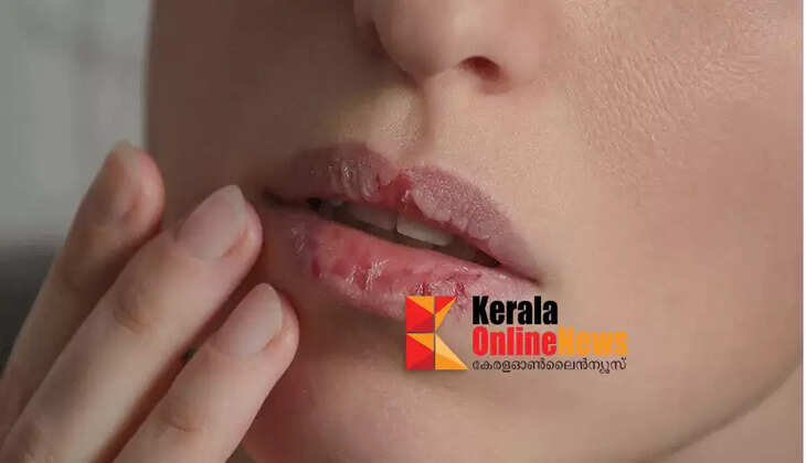 lips