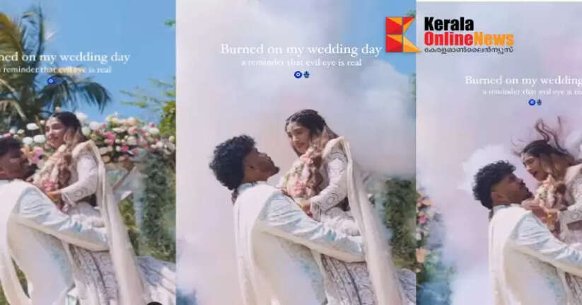 Photoshoot turned into color; Color bomb misses target, couple injured on wedding day