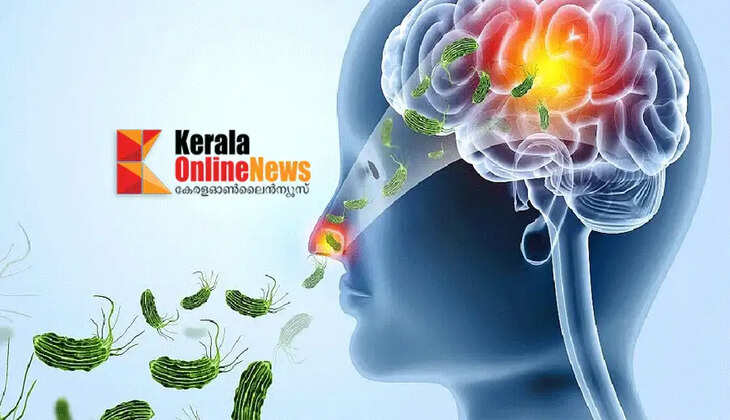 Amoebic encephalitis outbreak in the state again, 20 people have died in the last four and a half months