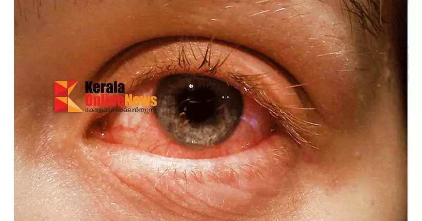 eye1