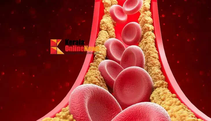 cholesterol