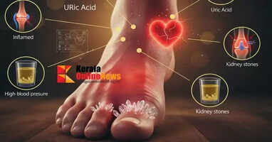 uric acid