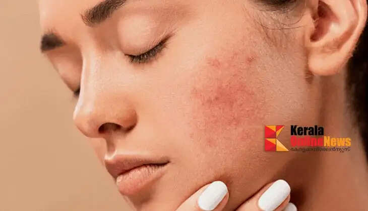 skinproblems