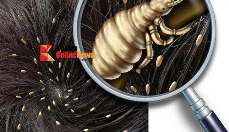 lice