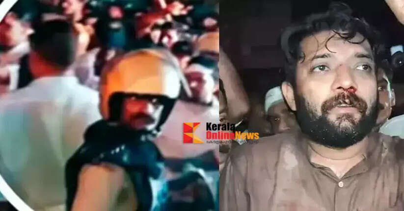 &lsquo;The person who beat me up in Perambra was CI Abhilash David, who was dismissed from service&rsquo;: Shafi Parambil