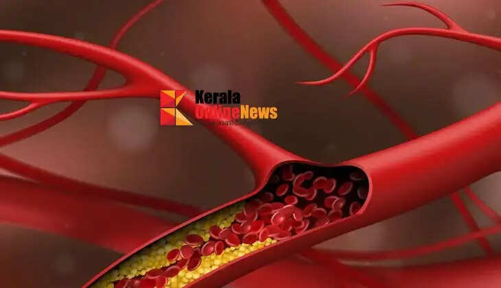 cholesterol