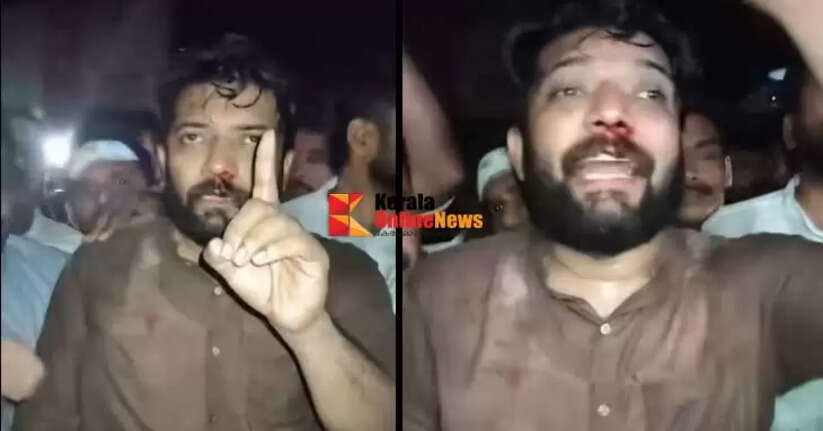 Congress-Police clash in Perambra Kozhikode Shafi Parambil MP injured