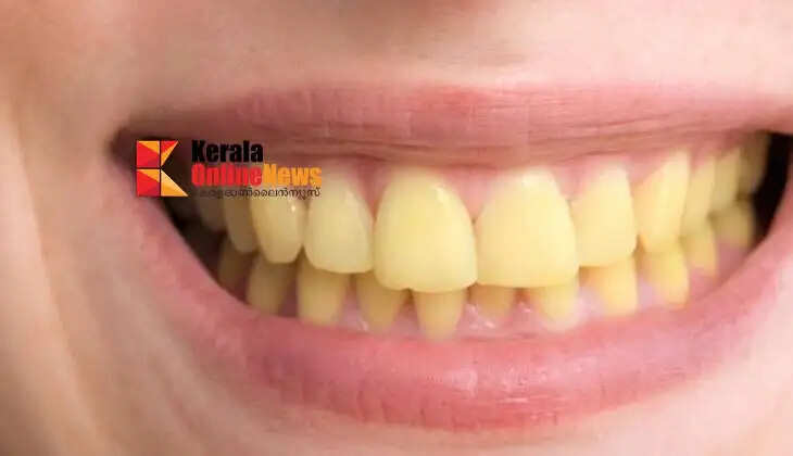 yellowteeth