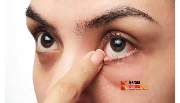 eyes