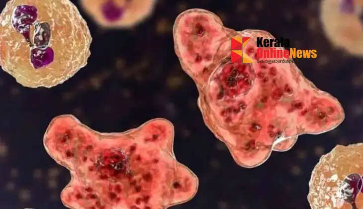 Amebic encephalitis: 14 deaths in 90 days, alert issued in the state