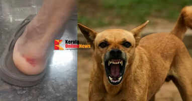 Middle-aged man bitten in stray dog ​​attack in Taliparamba Poomangalam